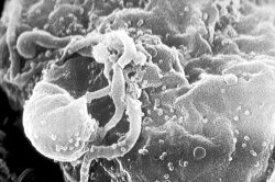 The AIDs Pandemic...25 Years Later