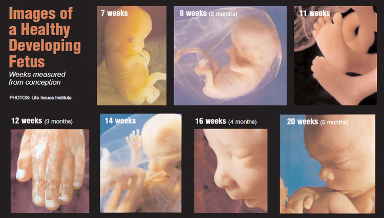 abortion_dev_fetus-ashz-090310.jpg